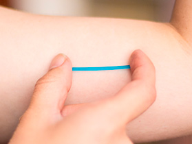 Implante subdérmico anticonceptivo